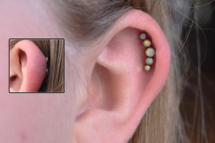 Dual-Point-Anatometal-Cluster
