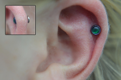 Helix-with-neometal-cab