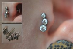 Tragus-CZ-cluster