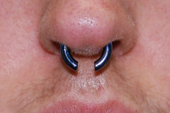 8g-Septum-Ti-CBR