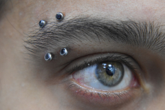 Dual-Neometal-Eyebrows-Healed