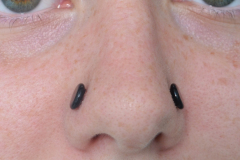 6mm-Nostrils-Healed