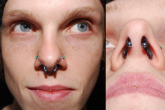 Light-blueseptum