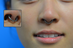 14g-3-8-CBR-Septum-Tucked