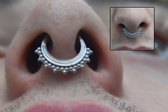 BVLA-Afghan-Septum-Healed