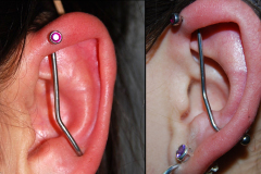 Front-helix-to-high-lobe
