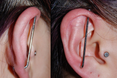 Helix-to-lobe-disc-indi