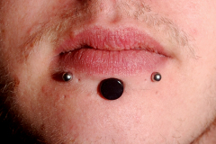 Half-Inch-Labret-healed