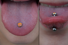 Orange-Opal-Tongue-Healed