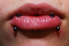 Dual-verital-lips-with-discs