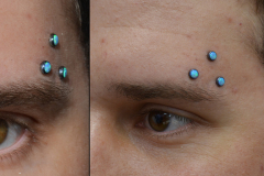 Triple-Opal-Anchors-above-Brow