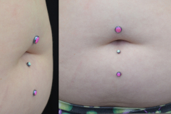 Triple-Navel-Anchors