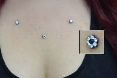 Flower-and-5mm-CZ-anchors-healed