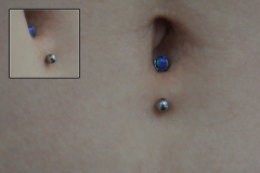 12g-Anti-navel-healed