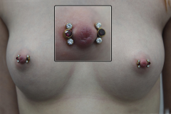 Dual-12g-Nipples-with-Anatometal-Clusters