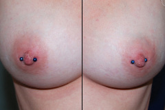 Dual-14g-Female-Nipples