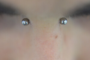 12g-Bridge-Healed-top-view