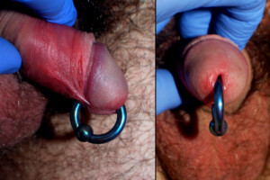 6g-CBR-PA