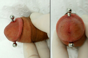 8g-Ap