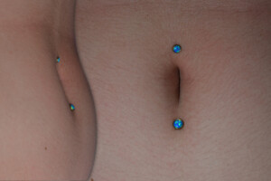 Above-and-under-navel-anchors