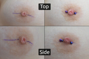 Blurple-12g-Inversion-Correction-LHS