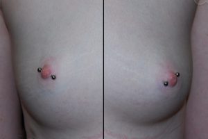 Dual-Diagonal-Nipple