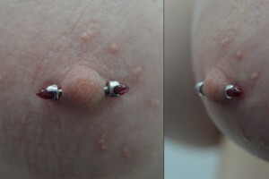 Female-nipple-with-anatometal-bullets