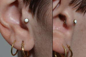 Gold-and-white-coral-tragus