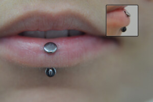 Healed-veritcal-labret