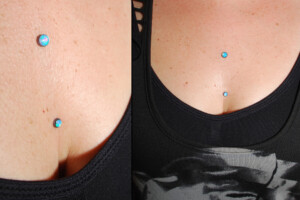 Light-Blue-Chest-Anchors