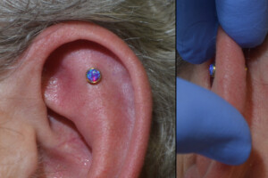 Opal-on-gold-outer-conch