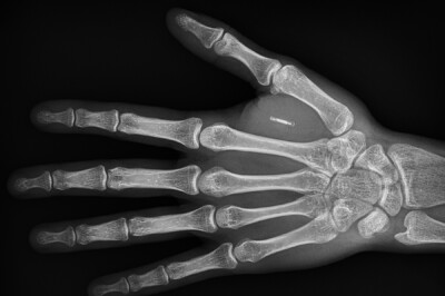 RFID-Hand