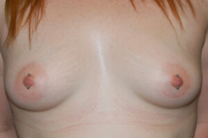 Vertical-Nipples