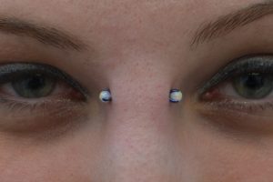 White-opal-bridge